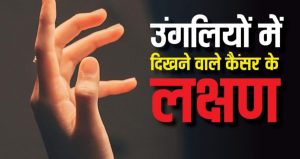 लंग कैंसर 